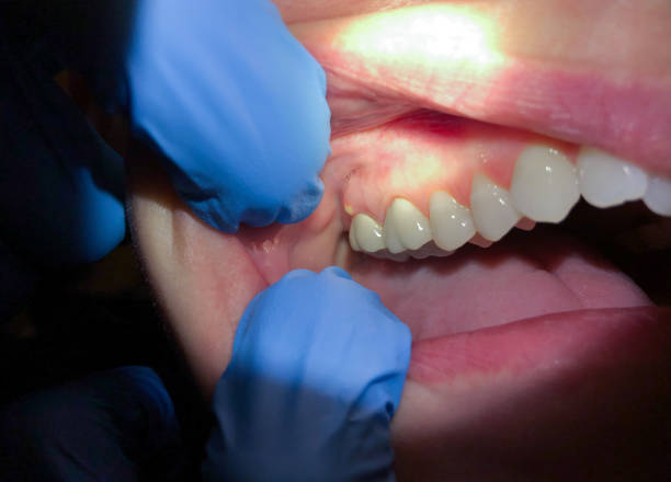 Best Weekend Emergency Dentist in Toast, NC