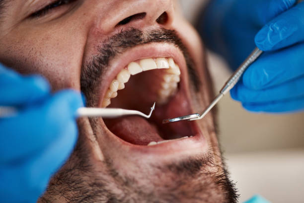 Best Mobile Emergency Dentist in Toast, NC