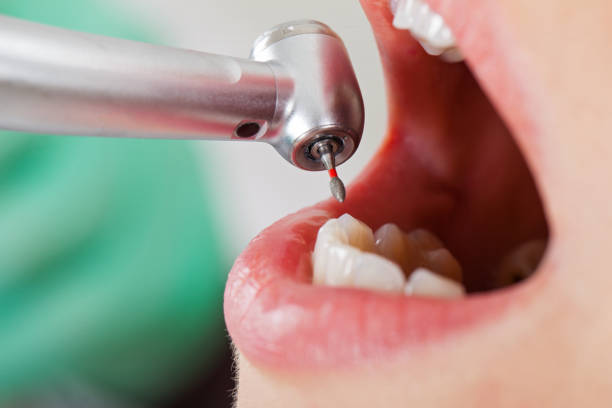 Best Urgent Dental Care for Toothache in Toast, NC